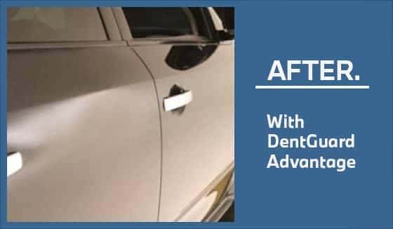 after-dentguard-image